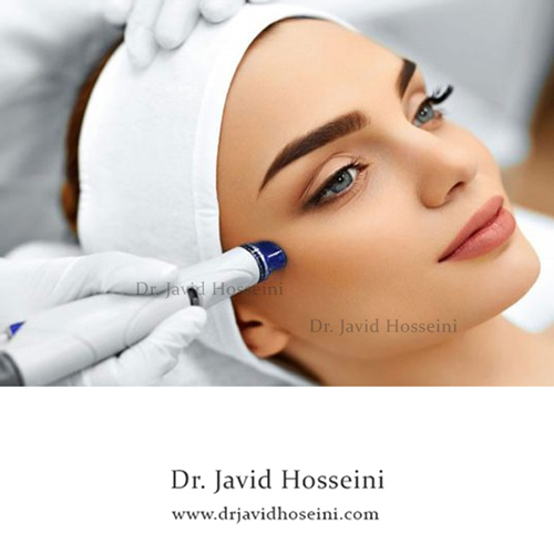 میکرونیدلینگ درمان جای جوش