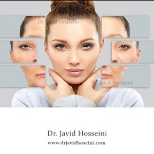 تزریق بوتاکس دکتر جاوید حسینی