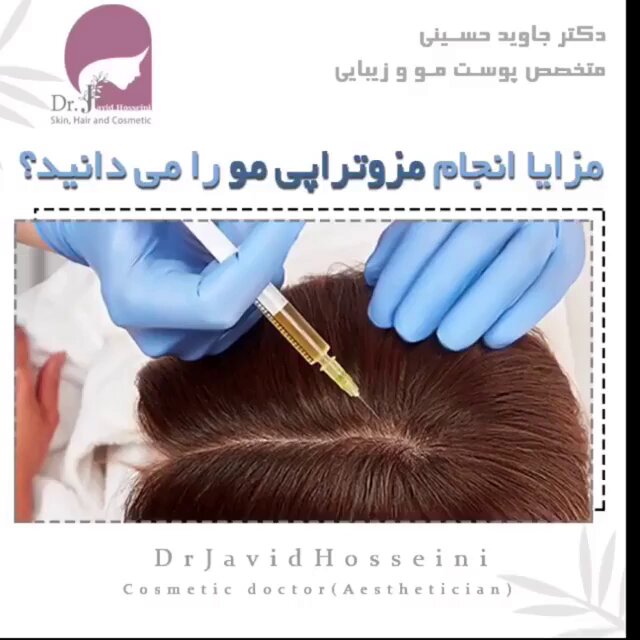 مزایای مزوتراپی مو با دکتر جاوید حسینی 
