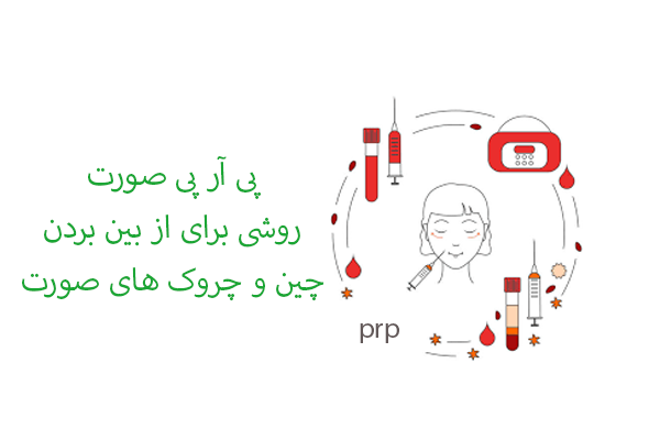 پی آر پی صورت، روشی برای جوانسازی صورت