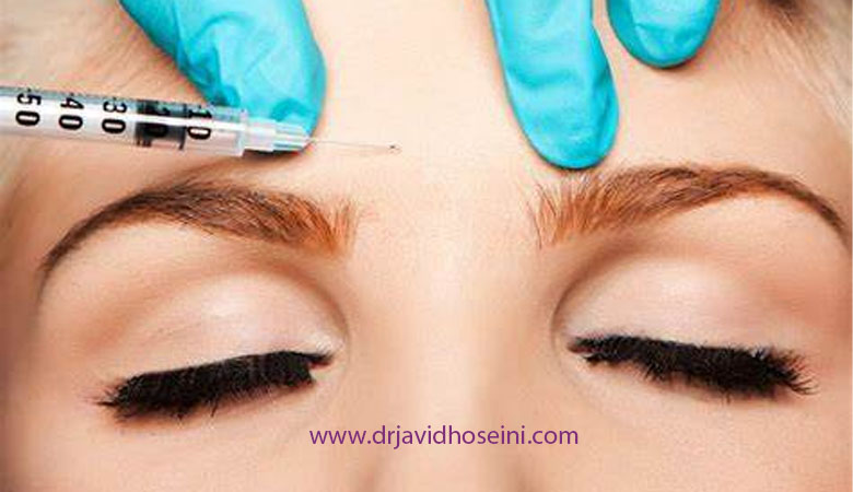 بوتاکس اخم چه کاربردی دارد؟