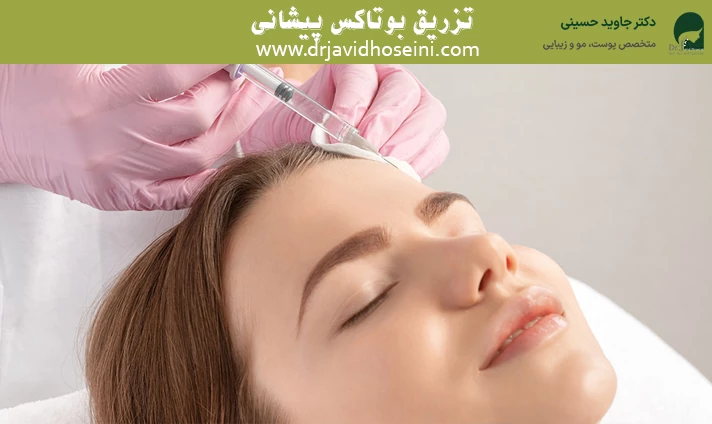 تزریق بوتاکس پیشانی