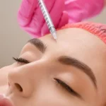 مراقبت های بعد از تزریق بوتاکس پیشانی