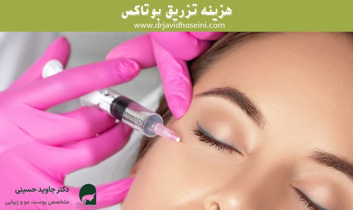 هزینه تزریق بوتاکس