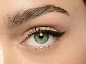 بوتاکس چشم گربه ای