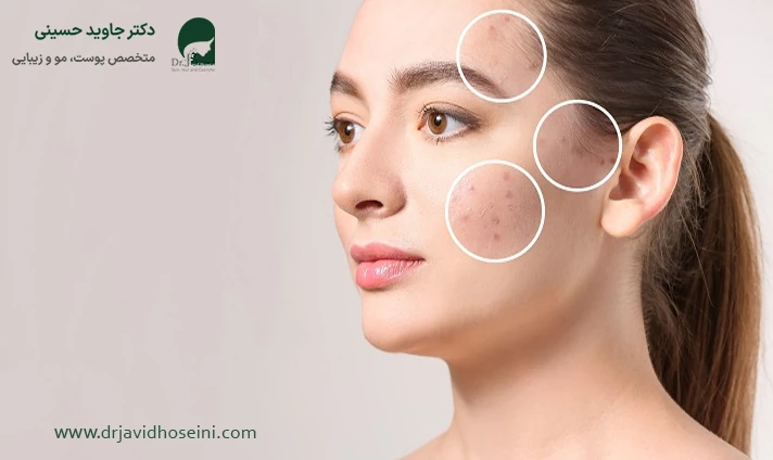 عوامل مؤثر بر هزینه سابسیژن