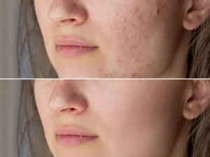 مدیریت هزینه سابسیژن