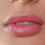 عکس تزریق ژل لب