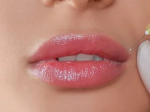 عکس تزریق ژل لب