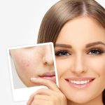 اقدامات بعد از سابسیژن