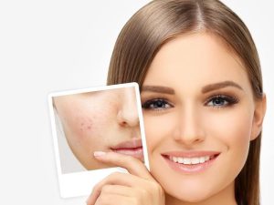 اقدامات بعد از سابسیژن