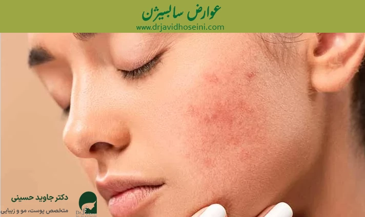 عوارض سابسیژن