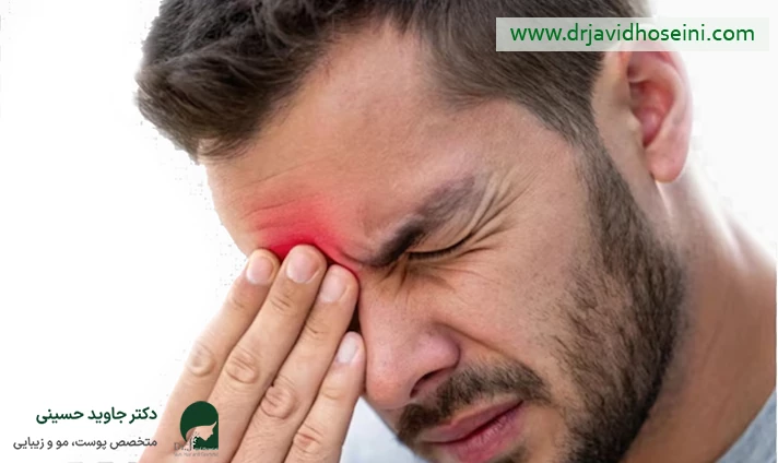 عوامل موثر بر میزان درد هنگام تزریق بوتاکس