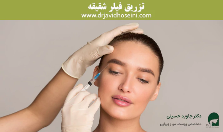 تزریق فیلر شقیقه