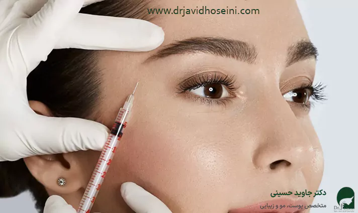 مزایای تزریق فیلر شقیقه