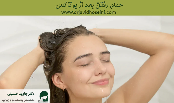 حمام رفتن بعد از بوتاکس