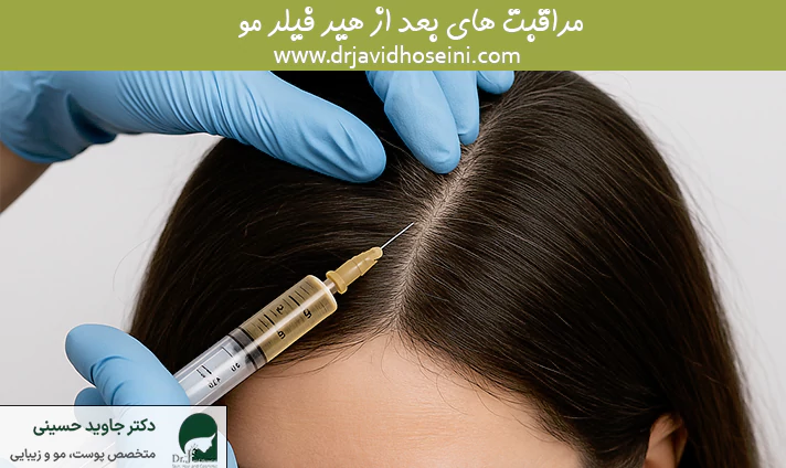 مراقبت های بعد از هیرفیلر مو