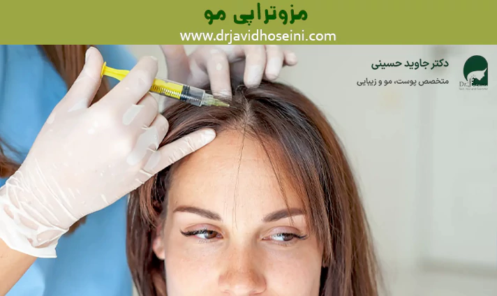 مزوتراپی مو