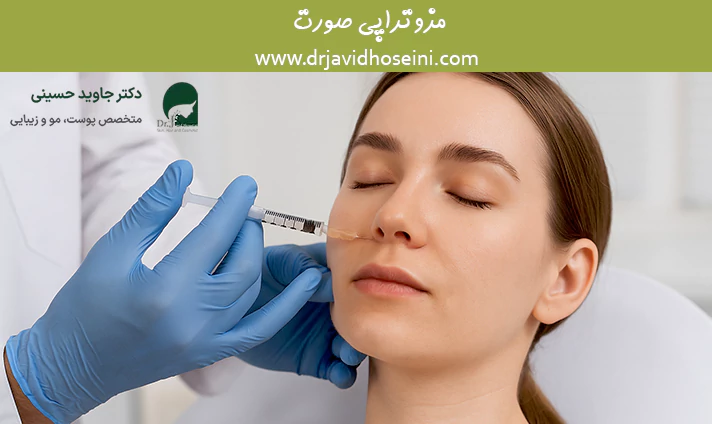 مزوتراپی صورت