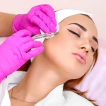 مراقبت بعد از مزوتراپی