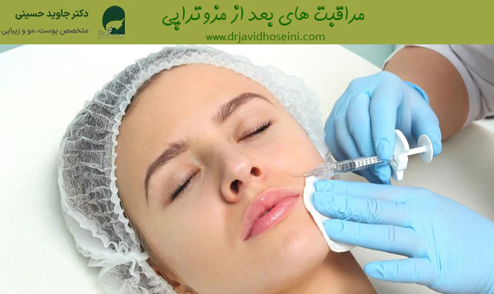 مراقبت های بعد از مزوتراپی
